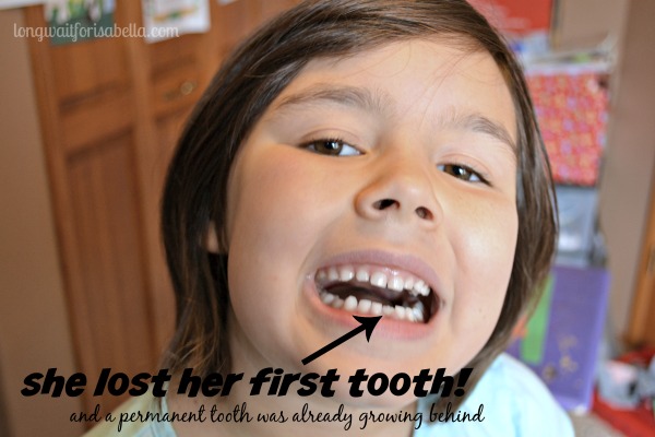 lost first tooth